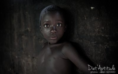 La malnutrition en Afrique de l’Ouest : Bénin